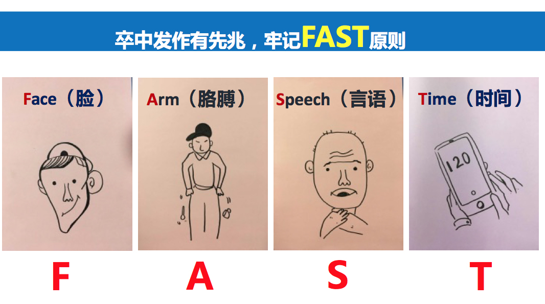 师母:大多数的脑卒中患者,都可以用"fast"原则进行判断.