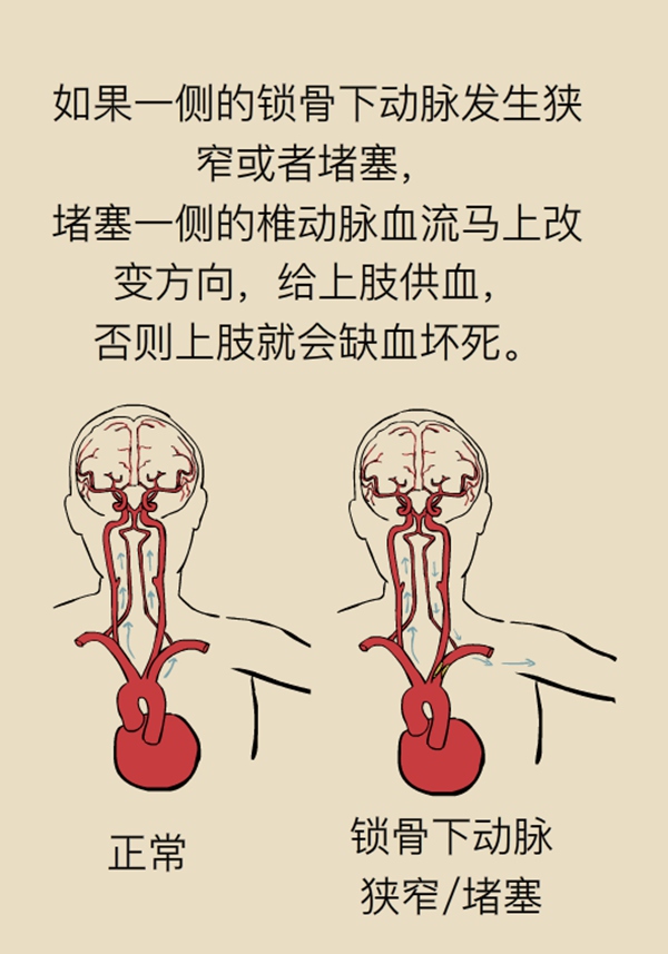 肺动脉关闭不全杂音叫什么_肺动脉瓣关闭不全心音_肺动脉关闭不全听诊