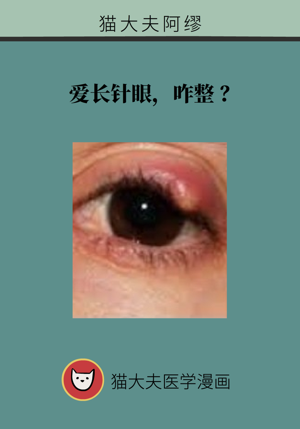 针眼一年复发五六次怎么办？戴隐形眼镜和化妆须注意这些